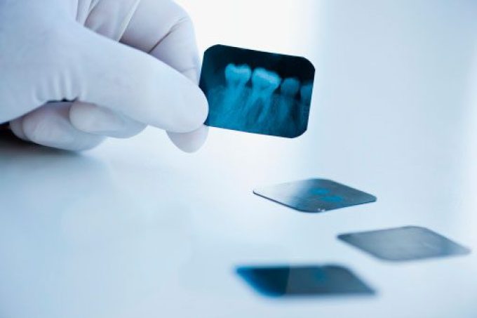 dentalux